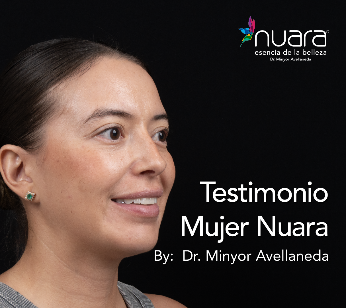 Blefaroplastia By Minyor Avellaneda