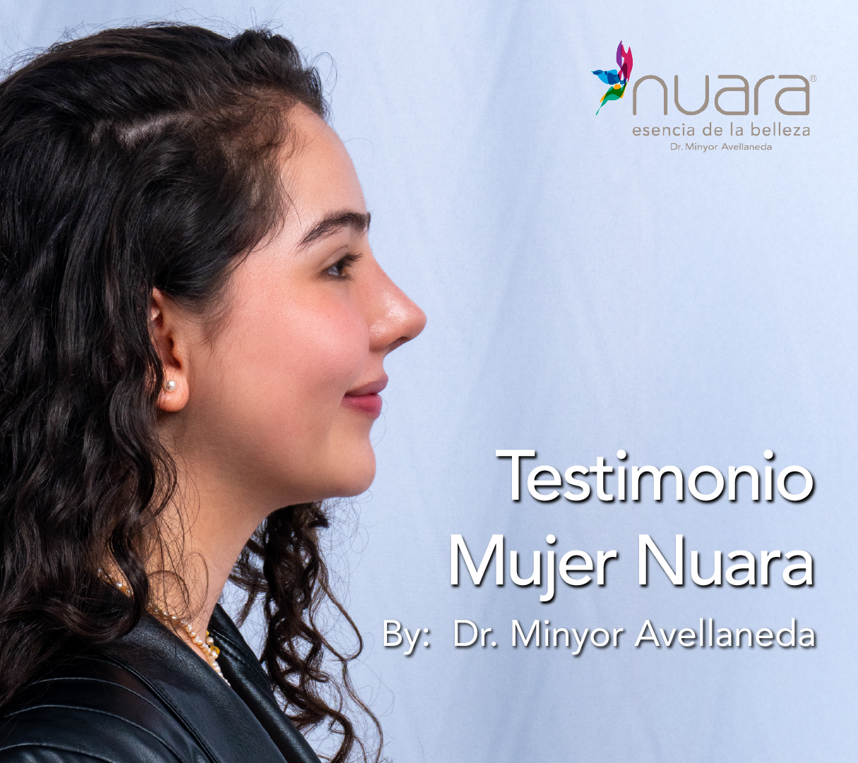 Testimonio Rinoplastia Ultrasónica By Dr. Minyor Avellaneda