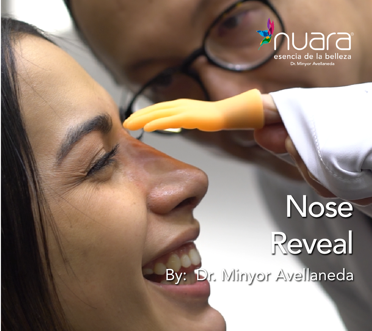 Rinoplastia Ultrasónica By Minyor Avellaneda