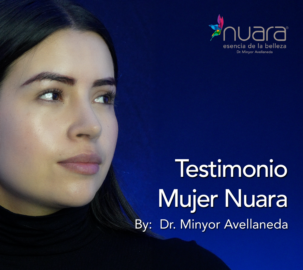 Testimonio Rinoplastia Ultrasónica By Dr. Minyor Avellaneda