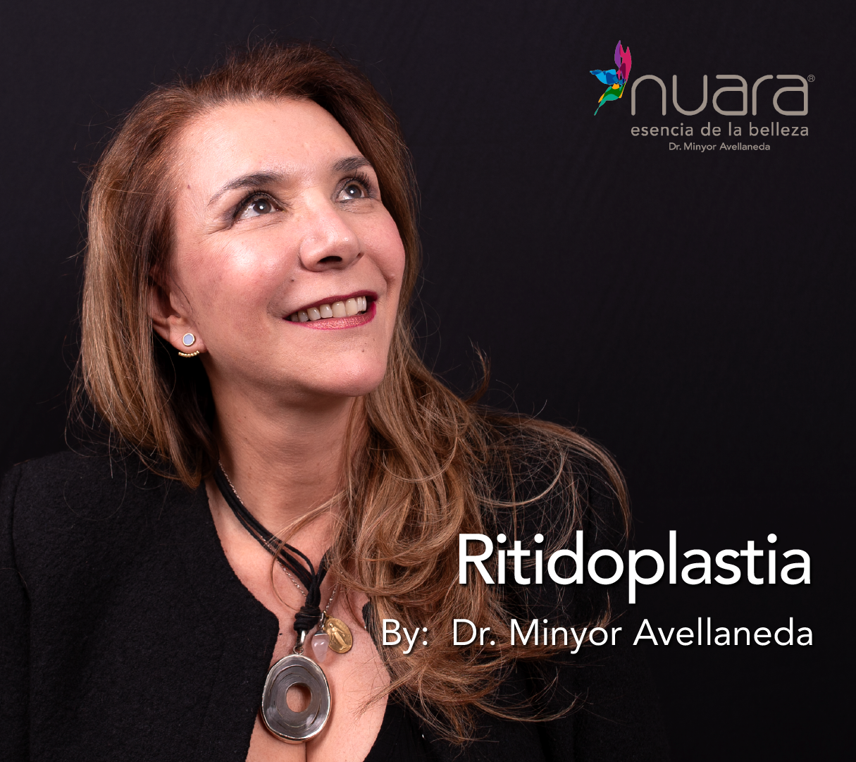 Ritidoplastia By Minyor Avellaneda