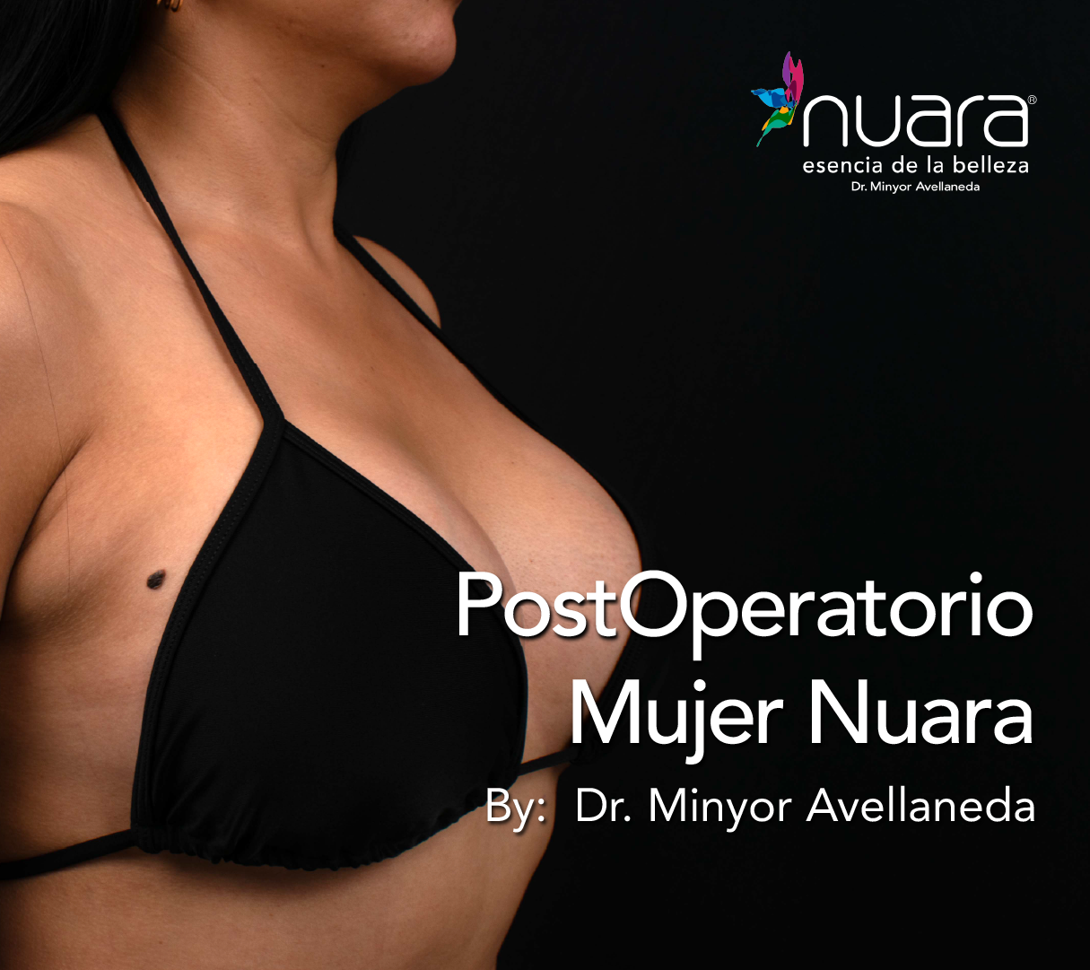 Mamoplastia de Aumento By Dr Minyor Avellaneda