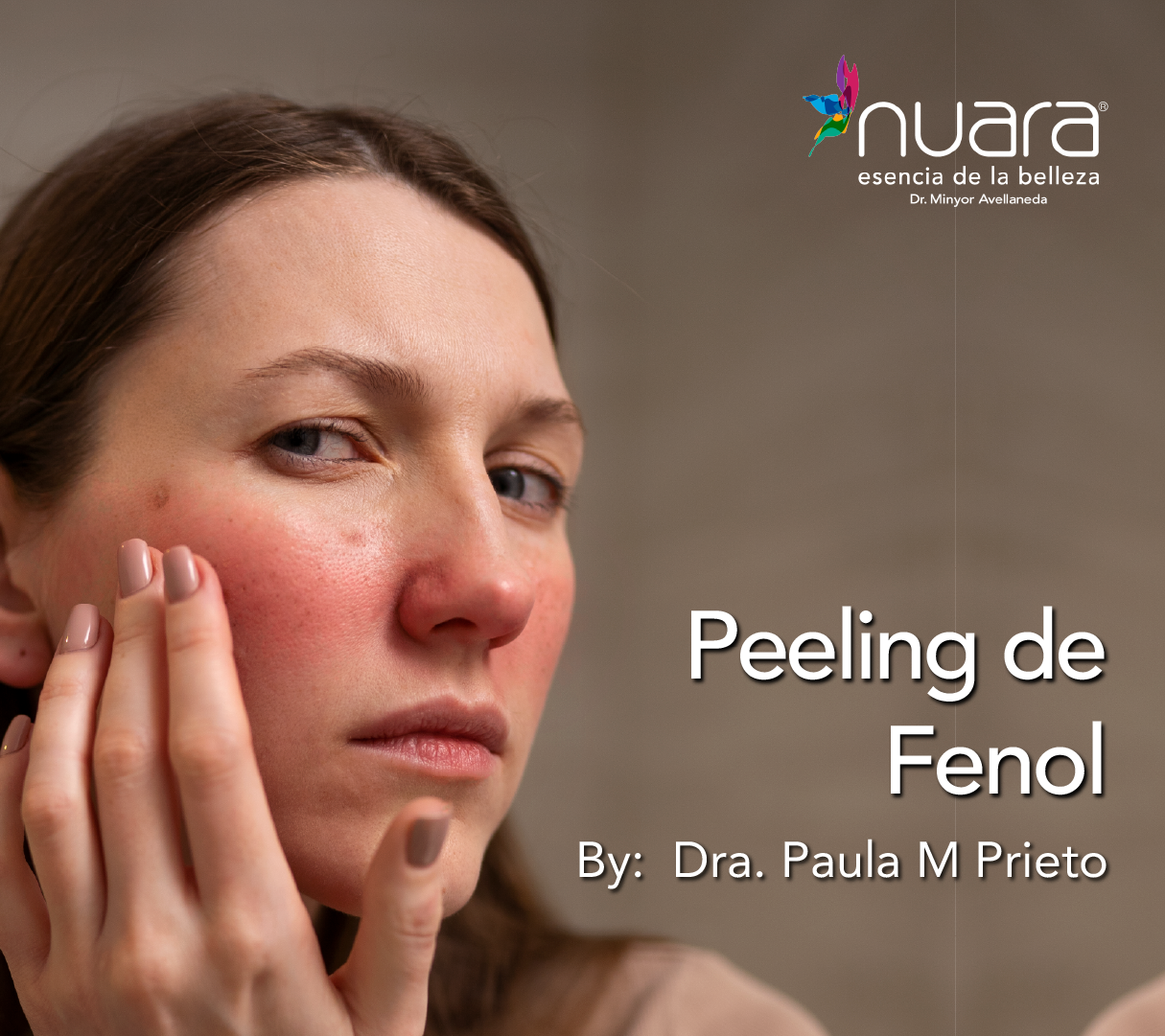 Peeling por Dra Paula M Prieto