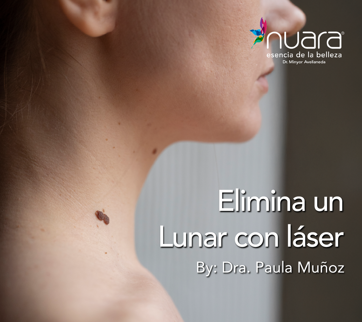 Láser Co2 por Dra Paula M Prieto