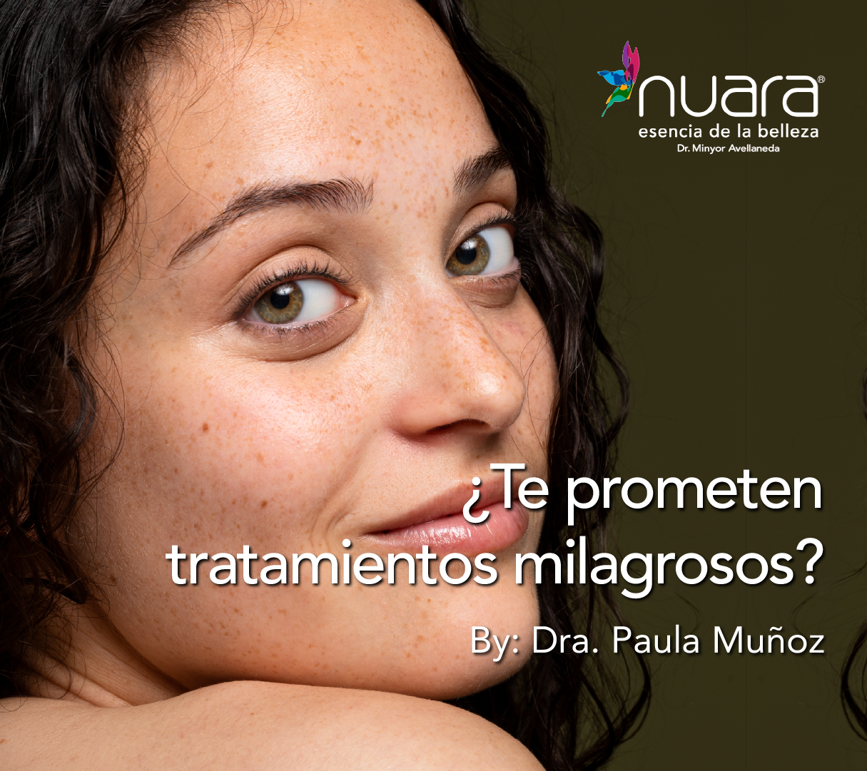 Protocolo Spot por Dra Paula M Prieto