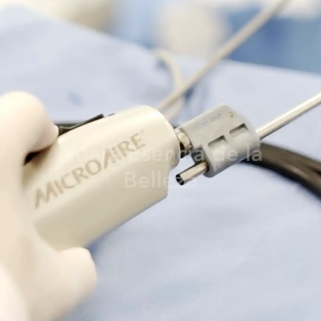 Equipos de última tecnología para cirugía plástica en Nuara Belleza {{brizy_dc_image_alt imageSrc=