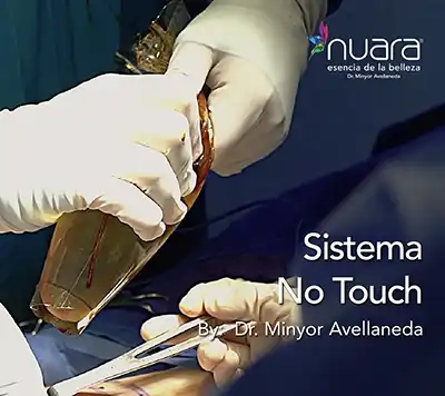 Asesoría Médica Mamoplastia - Dr. Minyor Avellaneda Dr. Minyor Avellaneda explicando la técnica de Mamoplastia de Aumento en Bogotá durante una valoración estética.