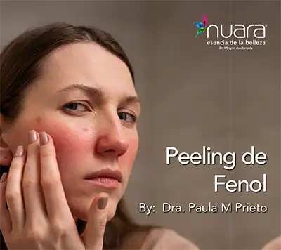 Peeling Facial l Nuara Esencia de la Belleza peeling de fenol nuara belleza Nuara Belleza