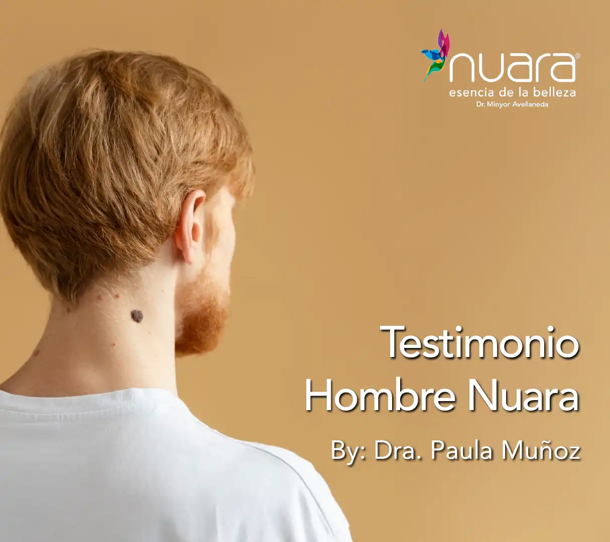 testimonio laser co2 Nuara Belleza