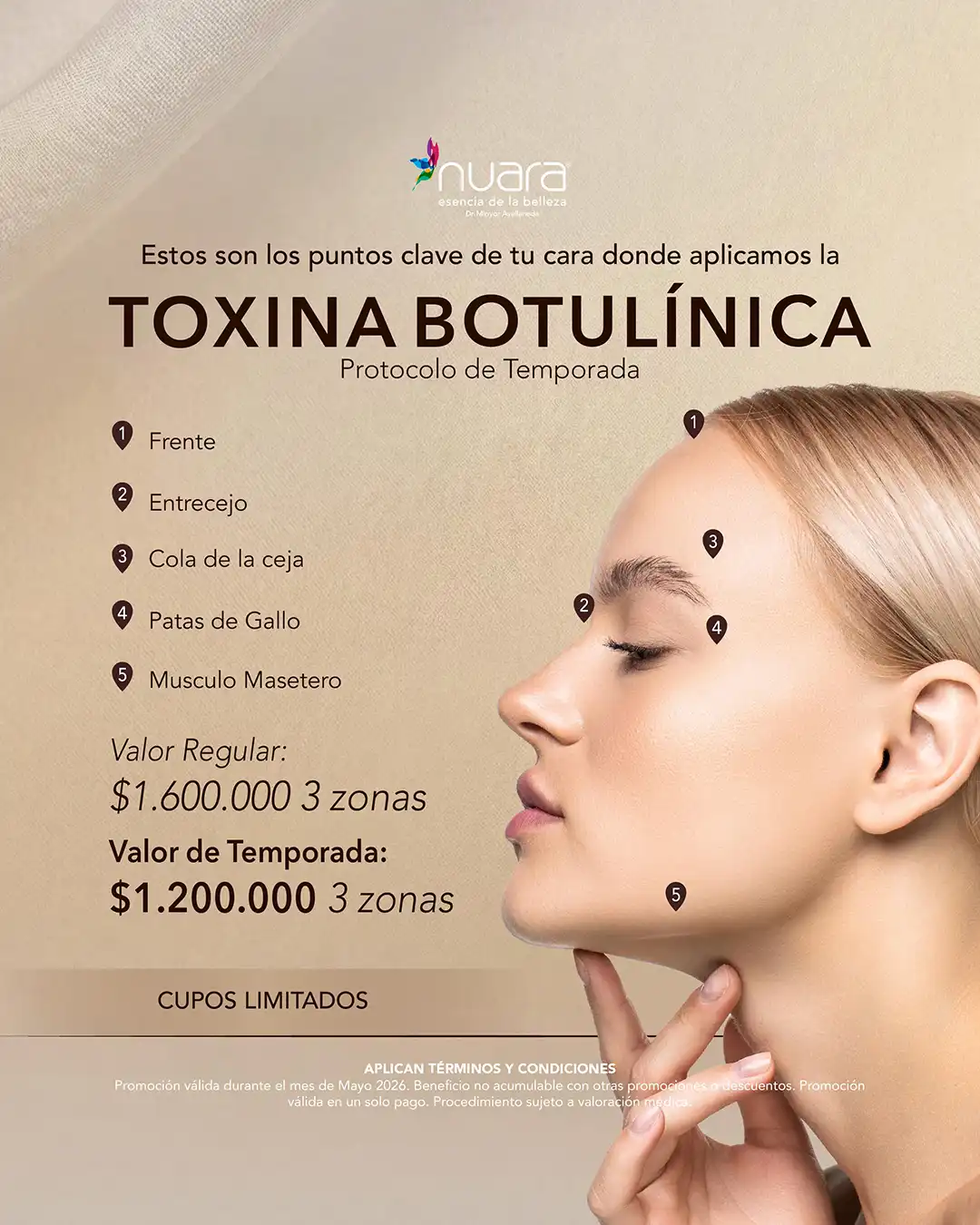 Promoción de Toxina Botulínica en Nuara Bogotá - Mayo 2026