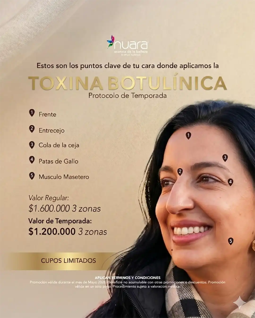 Promoción de Toxina Botulínica en Nuara Bogotá - Mayo 2026