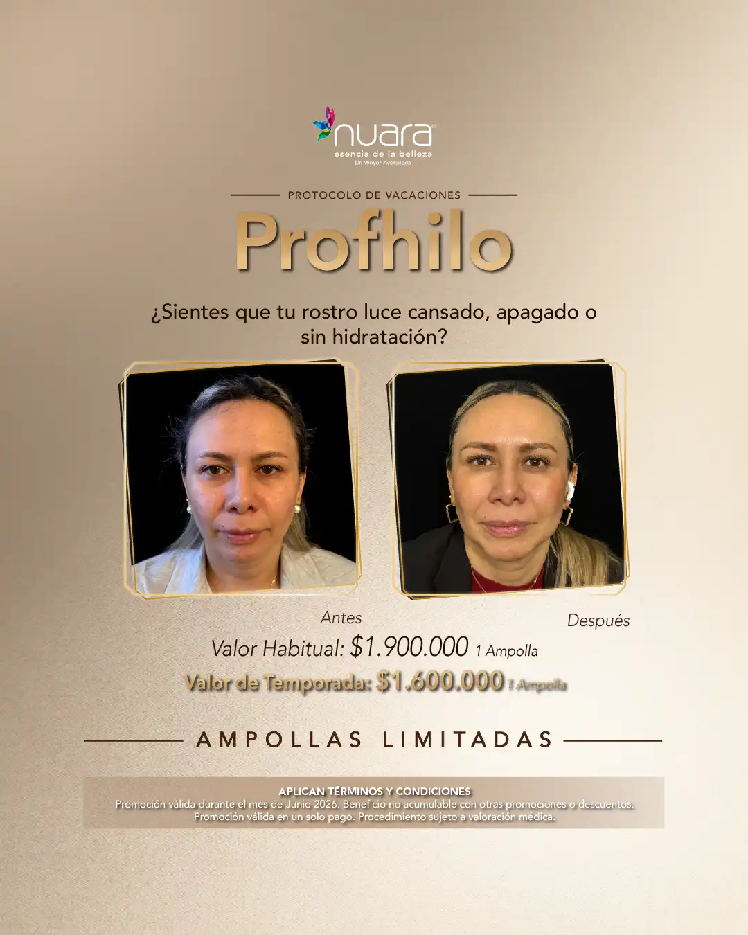 Promoción Profhilo AD en Nuara Bogotá - Junio 2026