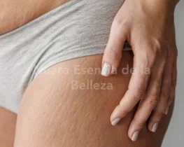 Celulitis con Enzimas