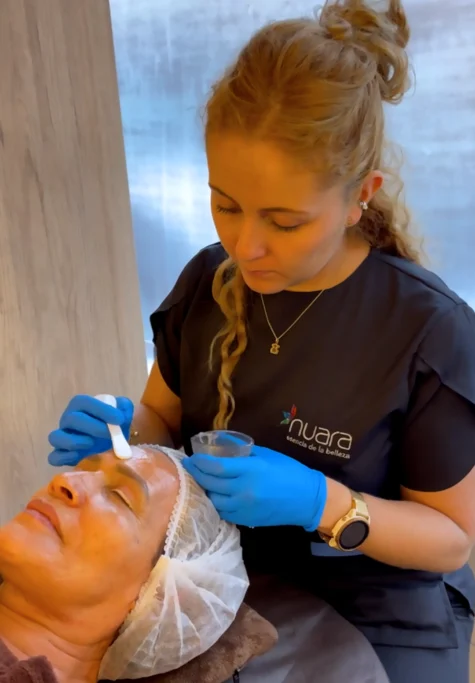 Peeling Facial por Dra Paula M Prieto