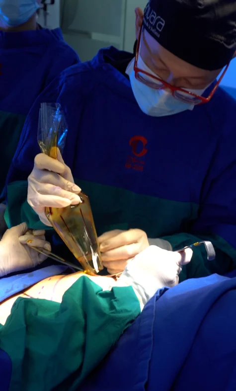Mamoplastia de Aumento By Dr Minyor Avellaneda