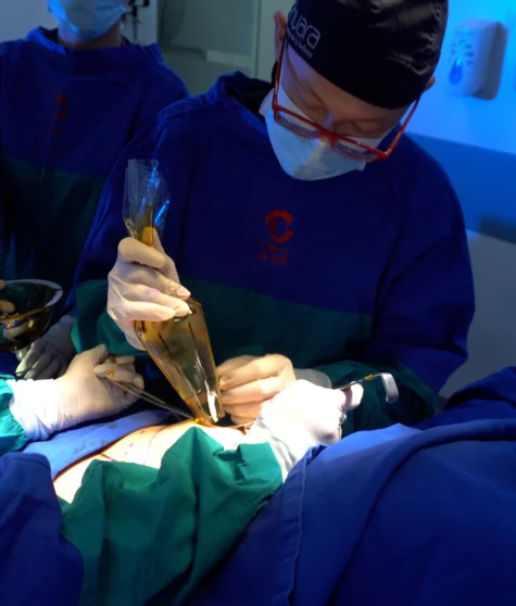 Mamoplastia de Aumento By Dr Minyor Avellaneda