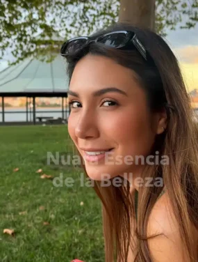 Resultado Natural Rinoplastia Ultrasónica Secundaria Bogotá rinoplastia ultrasonica secundaria bogota resultado natural rostro Nuara Belleza